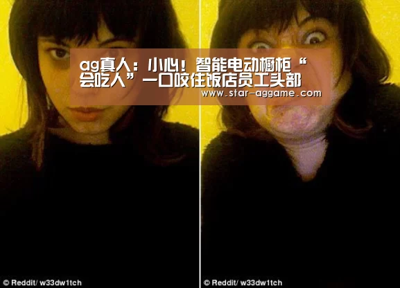 ag真人:小心!智能电动橱柜“会吃人”一口咬住饭店员工头部(图1) ag真人
